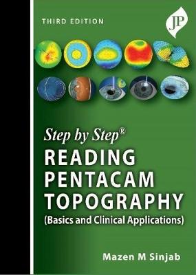 Step by Step Reading Pentacam Topography(Basics and Clinical Applications), 3e