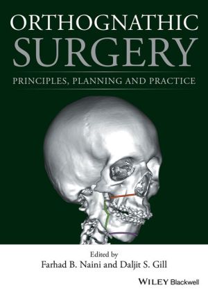 Orthognathic Surgery - Principles, Planning and Practice
