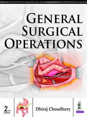 General Surgical Operations, 2e