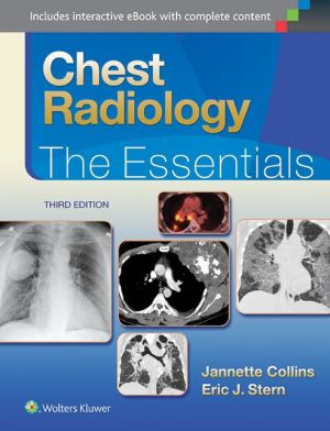 Chest Radiology: The Essentials 3E