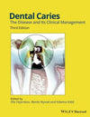 Dental Caries: The Disease and its Clinical Management, 3e