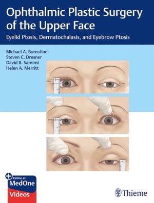 Ophthalmic Plastic Surgery of the Upper Face : Eyelid Ptosis, Dermatochalasis, and Eyebrow Ptosis