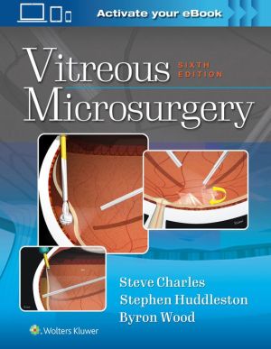 Vitreous Microsurgery, 6e