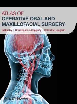 Atlas of Operative Oral and Maxillofacial Surgery** | Book Bay KSA