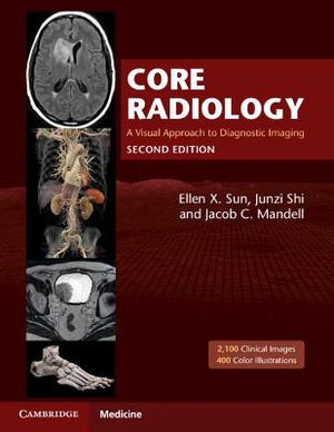 Core Radiology : A Visual Approach to Diagnostic Imaging, 2-Volume Set, 2e