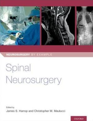 Spinal Neurosurgery