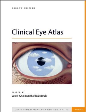 Clinical Eye Atlas (Oxford Atlases in Ophthalmology), 2e**