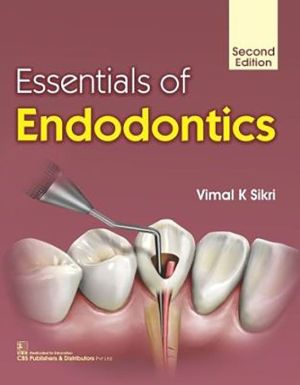 Essentials of Endodontics, 2e