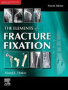 The Elements of Fracture Fixation, 4e