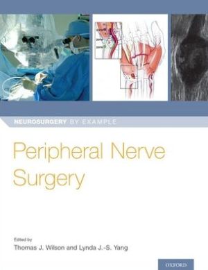 Peripheral Nerve Surgery