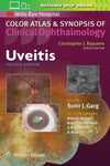 Uveitis (Color Atlas and Synopsis of Clinical Ophthalmology), 2e**
