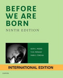 Before We Are Born : Essentials of Embryology and Birth Defects (IE), 9e