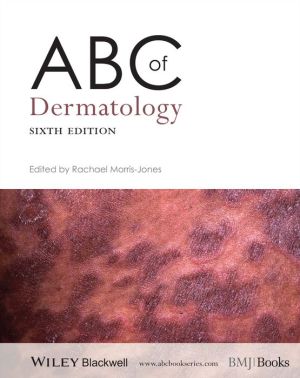 ABC of Dermatology, 6e **