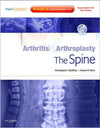 Arthritis and Arthroplasty: The Spine **