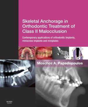 Skeletal Anchorage in Orthodontic Treatment of Class II Malocclusion **