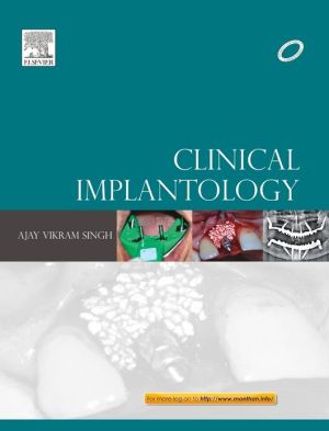 Clinical Implantology