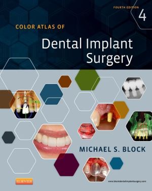 Color Atlas of Dental Implant Surgery, 4e