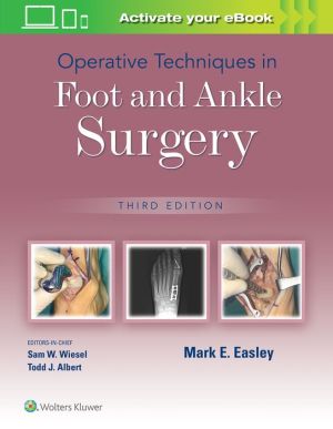 Operative Techniques in Foot and Ankle Surgery, 3e