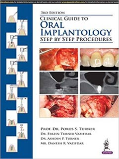 Clinical Guide to Oral Implantology: Step by Step Procedures 3/e
