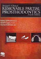 Stewart's Clinical Removable Partial Prosthodontics, 4e