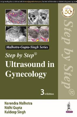 Step by Step Ultrasound in Gynecology, 3e