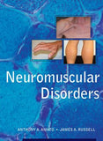 Neuromuscular Disorders ** | Book Bay KSA