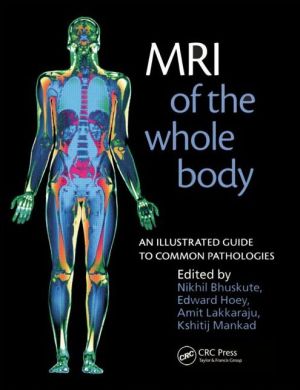 MRI of the Whole Body