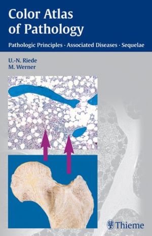 Color Atlas of Pathology : Pathologic Principles, Associated Diseases, Sequela