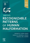 Smith's Recognizable Patterns of Human Malformation , 8e