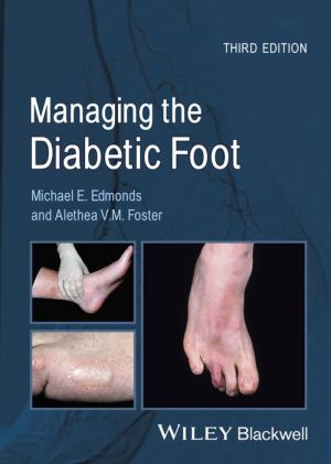 Managing the Diabetic Foot, 3e