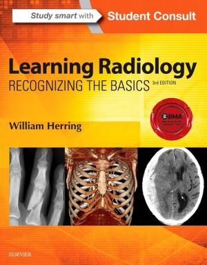 Learning Radiology : Recognizing the Basics, 3e**