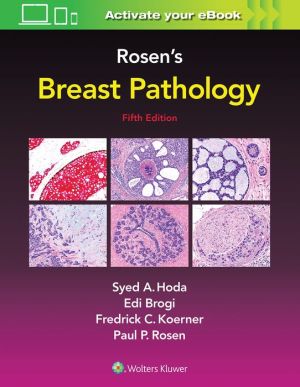 Rosen's Breast Pathology, 5e