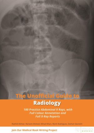 The Unofficial Guide to Surgery: Core Operations, 2e