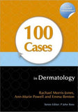 100 Cases in Dermatology