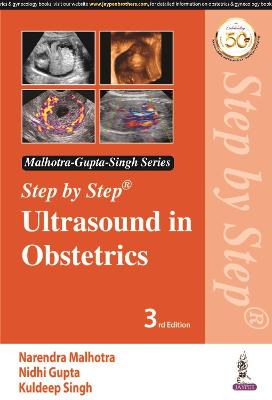 Step by Step Ultrasound in Obstetrics, 3e