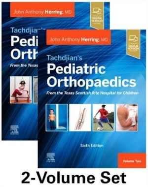 Tachdjian's Pediatric Orthopaedics: From the Texas Scottish Rite Hospital for Children : 2-Volume Set, 6e