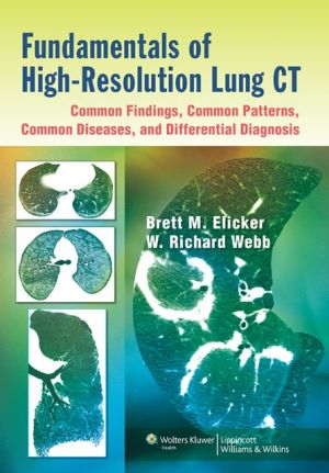 Fundamentals of High-Resolution Lung CT: Common Findings, Common Patterns, Common Diseases, and Differential Diagnosis : Common Findings, Common Patterns, Common Diseases, and Differential Diagnosis** | Book Bay KSA