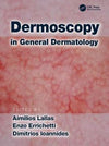 Dermoscopy in General Dermatology
