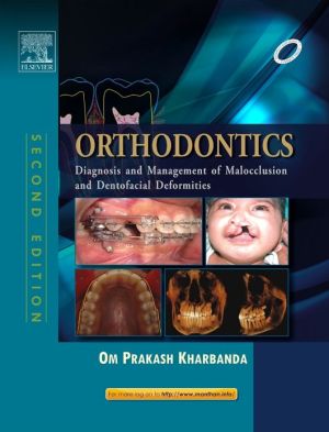 Orthodontics: Diagnosis and Management of Malocclusion and Dentofacial Deformities, 2e