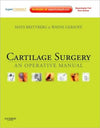 Cartilage Surgery **