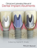 Clinical and Laboratory Manual of Dental Implant Abutments