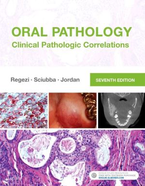 Oral Pathology, Clinical Pathologic Correlations, 7e