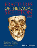 Fractures of the Facial Skeleton 2e