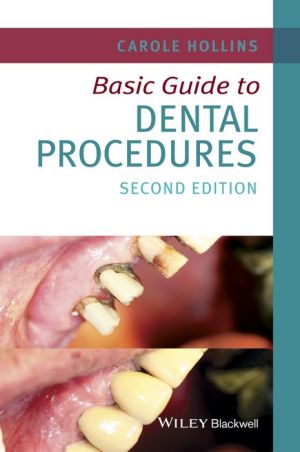 Basic Guide to Dental Procedures 2e