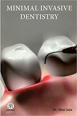 Minimal Invasive Dentistry