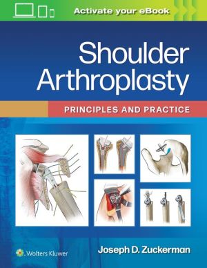 Shoulder Arthroplasty : Principles and Practice