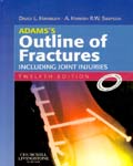 Adams's Outline of Fractures 12e **