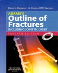 Adams's Outline of Fractures: Including Joint Injuries (IE), 12e**
