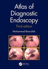Atlas of Diagnostic Endoscopy, 3e | Book Bay KSA