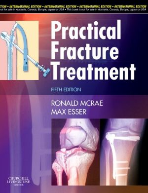 Practical Fracture Treatment (IE), 5e